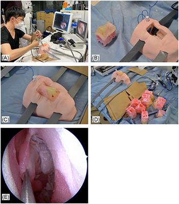 Can high-fidelity 3D models be a good alternative for cadaveric materials in skill assessment for endoscopic sinus surgery? A comparison study in assessment for surgical performance in 3D models and cadavers